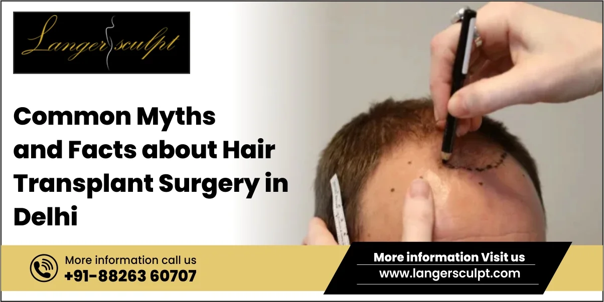 Common Myths and Facts about Hair Transplant Surgery in Delhi