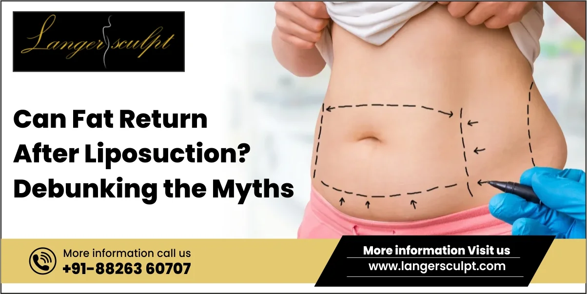 Can Fat Return After Liposuction? Debunking the Myths