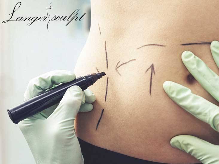 Is liposuction a painful surgery?