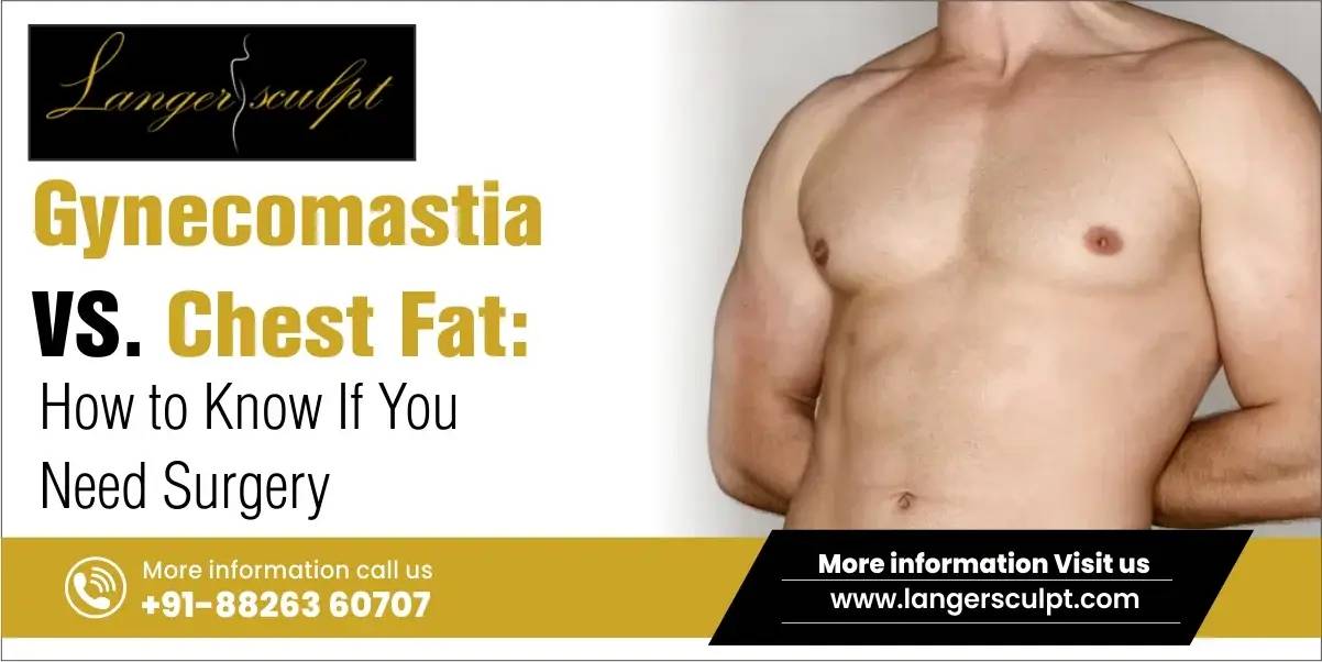 Gynecomastia vs. Chest Fat: How to Know If You Need Surgery?