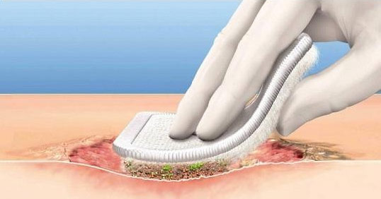 Enzymatic debridement of large burn wounds with papain-urea: Is it safe?