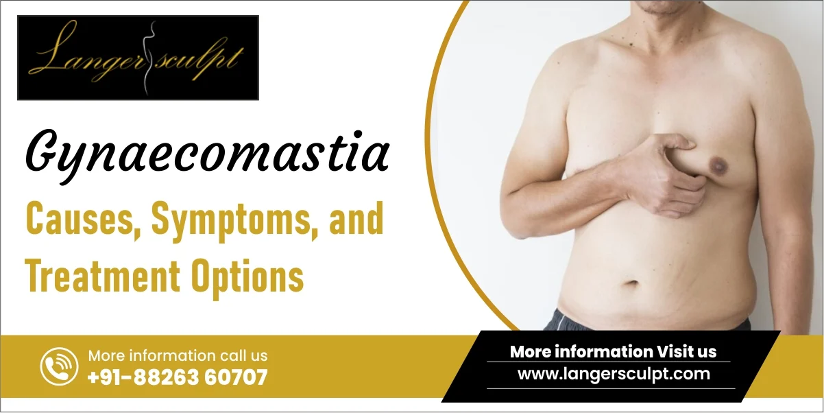 Gynaecomastia: Causes, Symptoms, and Treatment Options