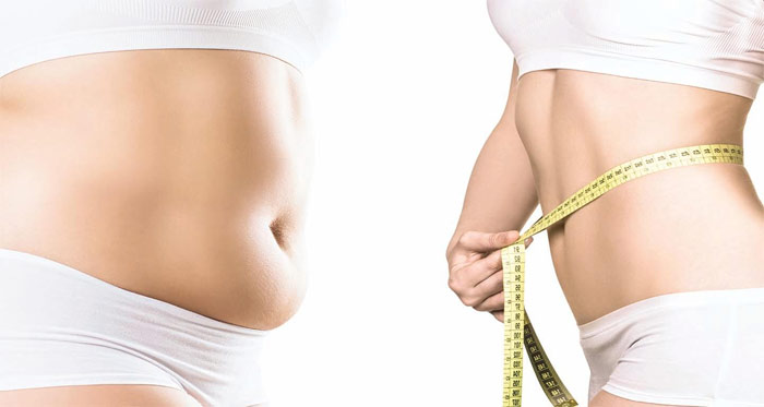 Body contouring following massive weight loss