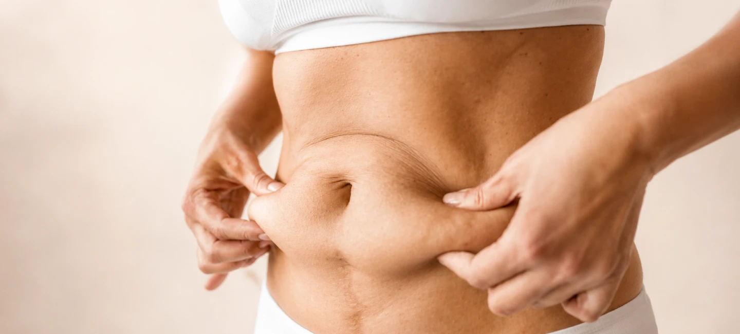 Tummy Tuck Surgery in Delhi