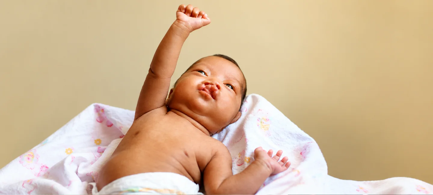 Cleft Lip And Palate Surgery In Delhi