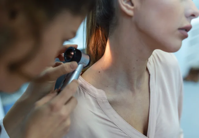 Removal of moles, cysts, skin tags and xanthelasma