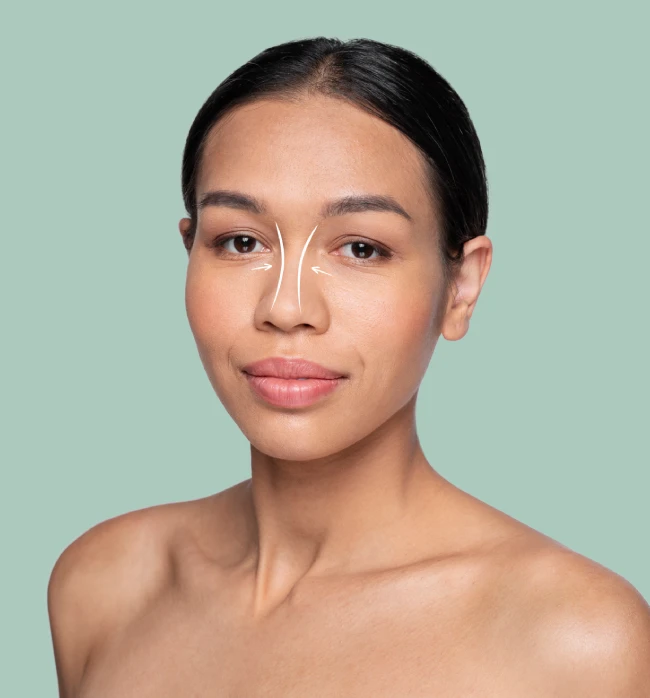 What is Rhinoplasty?