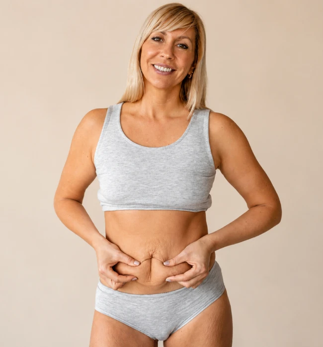 What Is a Tummy Tuck?
