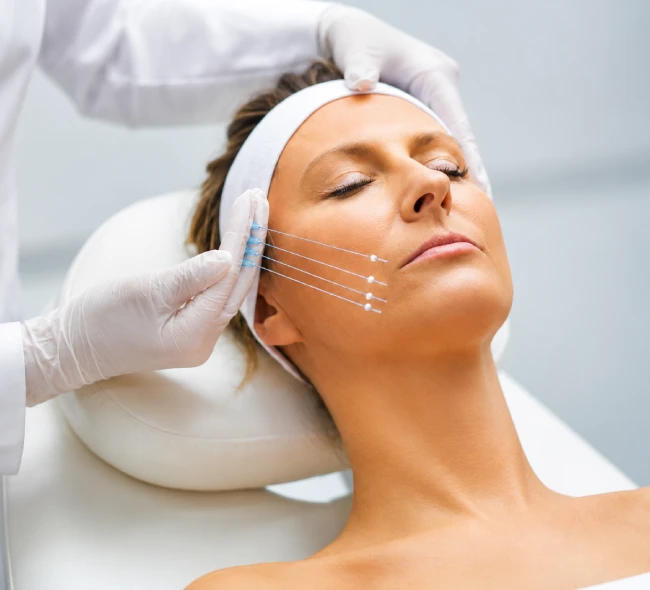Types of Threads Used in Thread Lift Treatment
