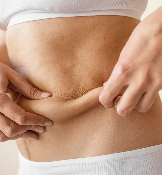 Popular Areas for Fat Grafting