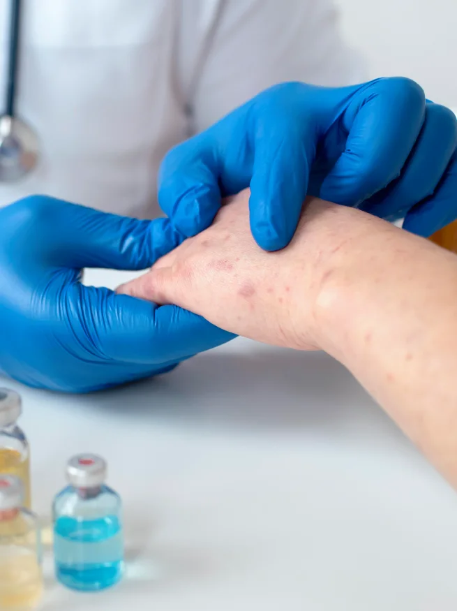 What are the Different Types of Scars?