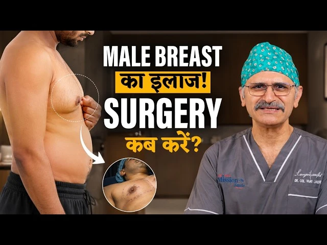 Gynecomastia vs Chest Fat: अंतर क्या है? उपचार और सर्जरी कब जरूरी है?