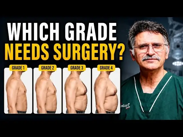 Gynecomastia vs Chest Fat: How to Identify All 4 Grades of Gynecomastia | Langersculpt Clinic